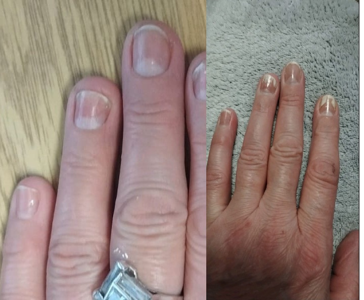 SOS - Before/After Nails