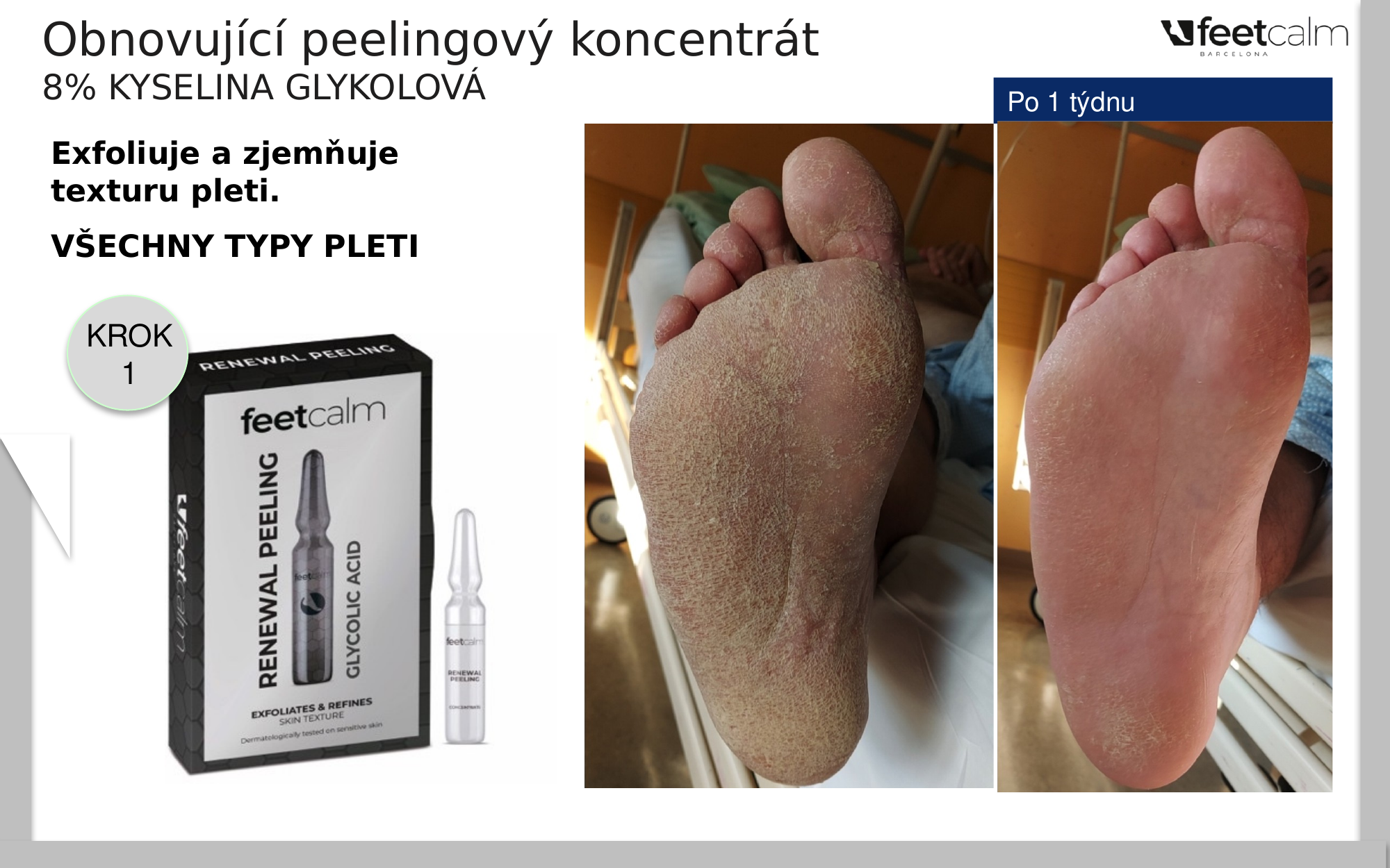 Renewing Peeling Concentrate